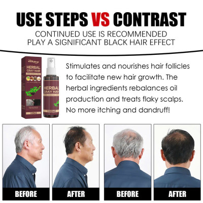 Phục Hồi Tóc Bạc Tại Nhà Hiệu Quả , Dưỡng Thảo Dược Đen Tóc, ĐÈN TRANG TRÍ , ĐỒNG HỒ TREO TƯỜNG