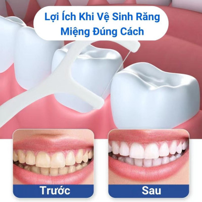 Phụ kiện nhà bếp phòng ăn - Set  hộp 50 cây tăm chỉ nha khoa ,an toàn dễ sử dụng