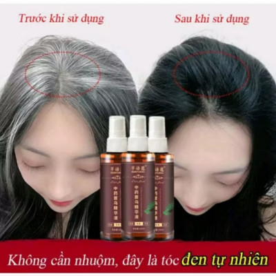 CHAI TINH DẦU THẢO MỘC XỊT ĐEN TÓC TÓC TRẮNG THÀNH TÓC ĐEN DƯỠNG TÓC CAO CẤP