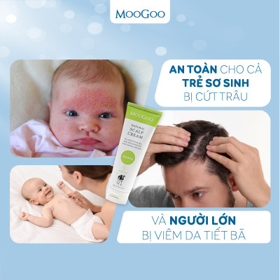 Kem dưỡng cho bé Viêm da tiết bã, Vảy nến chiết xuất Dầu tràm Moogoo Úc thuần chay, lành tính