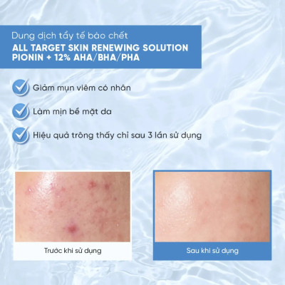 Dung dịch tẩy tế bào chết và tái tạo da Emmié All Target Skin Renewing Solution Pionin + 12% AHA/BHA/PHA (120ml) - Hàng chính hãng