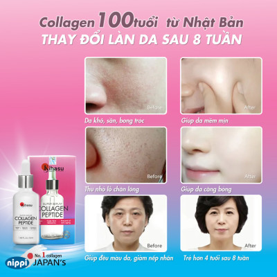 Serum Collagen KIHASU Dưỡng Trắng Sáng Da, Làm Mờ Vết Sạm, Tàn Nhang, Trẻ Hóa Làn Da, Hiệu Quả Sau 8 Tuần Sử Dụng
