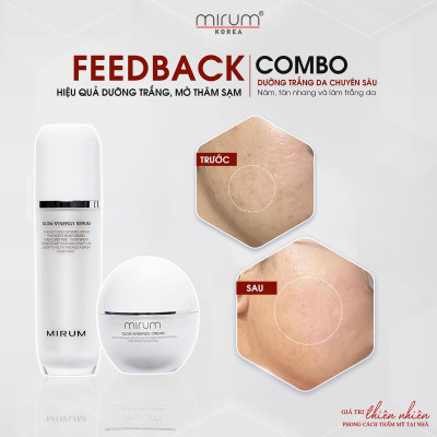 Tinh Chất dưỡng trắng da #Nám, #Tàn_Nhang & Làm_Trắng Da Mirum 45ml – Mirum Glow Synergy Serum