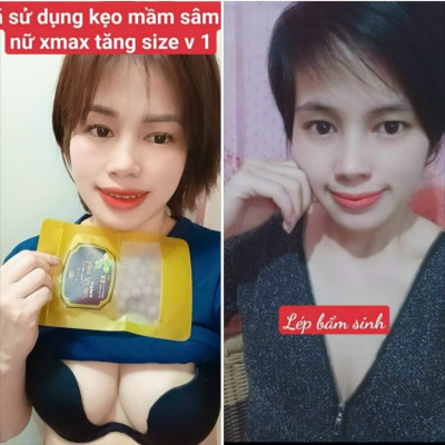 1 hộp Kẹo mầm sâm tố nữ Xmax