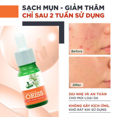 Serum Giảm Mụn Oriss Tinh Chất Tràm Trà Hỗ Trợ Mờ Thâm Sạch Mụn 10g