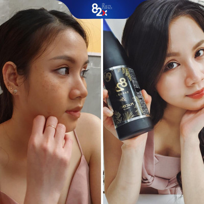 ĐẸP NÕN NÀ - DA PHỦ SƯƠNG CĂNG MƯỚT Combo 3 Chai: COLLAGEN + SAKURA COLLAGEN + SAKURA PLACENT Nước Uống Đẹp Da Nhật Bản