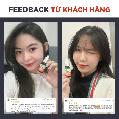 Serum Giảm Mụn Oriss Tinh Chất Tràm Trà Hỗ Trợ Mờ Thâm Sạch Mụn 10g