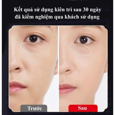 Dụng Cụ day ấn Huyệt Mát xa toàn thân kiểu Thái bằng gỗ Chăm sóc sức khỏe