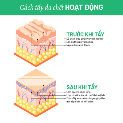 Gel Tẩy Da Chết Body Gừng Tràm Trà Heebee