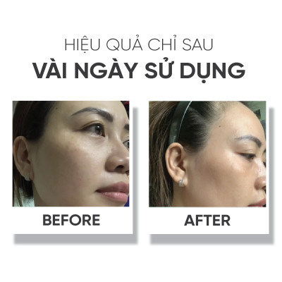 Bộ sản phẩm dưỡng da LÁ HOUSE gồm Toner Astalock,Bông tẩy trang