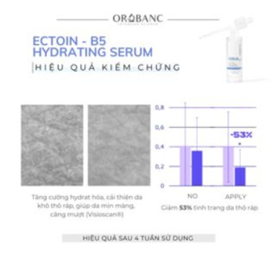 Tinh chất cấp ẩm, căng bóng da Orobanc Ectoin B5 Hydrating serum 30mL